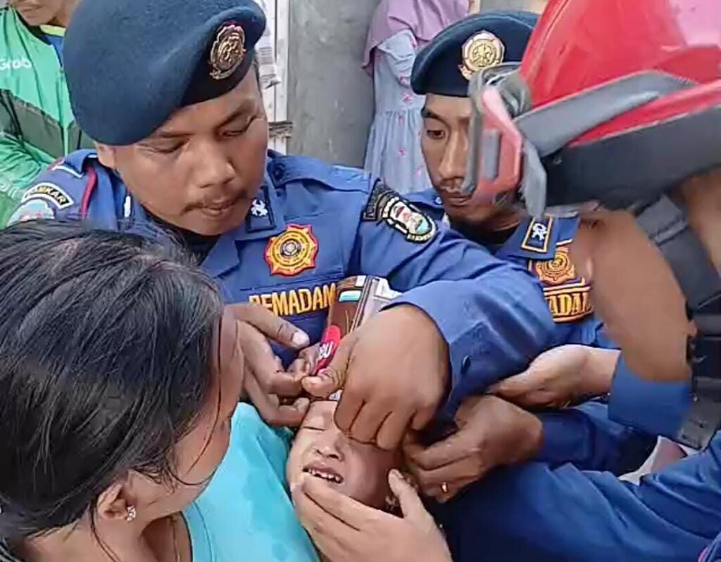 1000893846 Petugas berusaha melepas kaleng biskuit yang tersangkut di kepala Balita di Kota Bandarlampung, Senin (21/7/2025). Istimewa