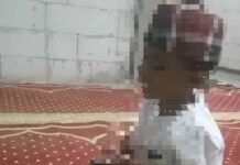Sulthon, bocah 7 tahun di Jombang yang menderita gizi buruk dan sakit jantung./bongkah.id/Karimatul Maslahah/